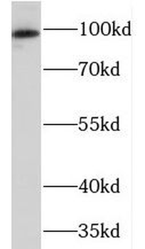 PRKD2 Rabbit Polyclonal Antibody