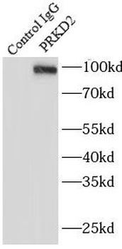 PRKD2 Rabbit Polyclonal Antibody