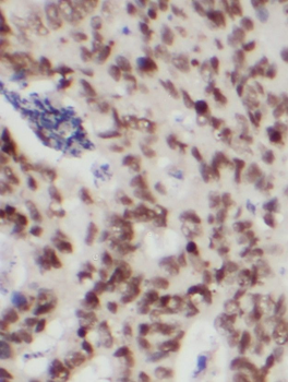 PRKD2 Rabbit Polyclonal Antibody