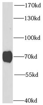 PRKG1 Rabbit Polyclonal Antibody