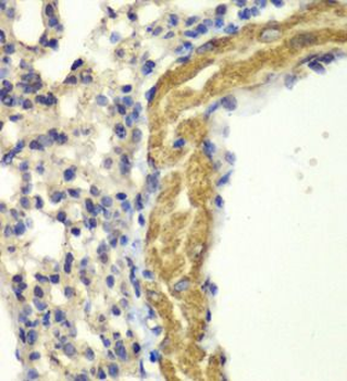 PRKG1 Rabbit Polyclonal Antibody