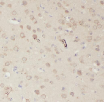 PRMT3 Rabbit Polyclonal Antibody