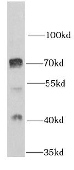 PRMT5 Rabbit Polyclonal Antibody