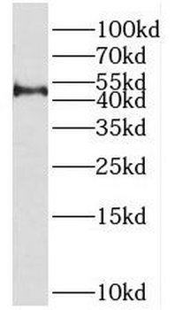 PRMT8 Rabbit Polyclonal Antibody