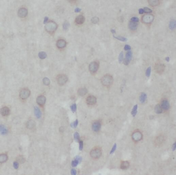 PRMT8 Rabbit Polyclonal Antibody