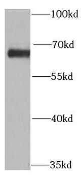 PRODH Rabbit Polyclonal Antibody