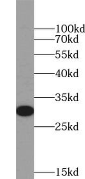 PHB1 Rabbit Polyclonal Antibody