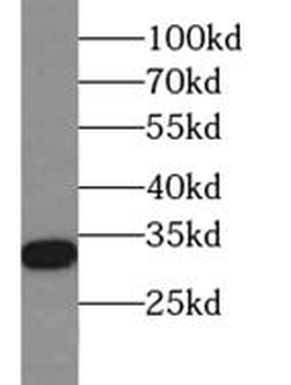 PHB2 Rabbit Polyclonal Antibody