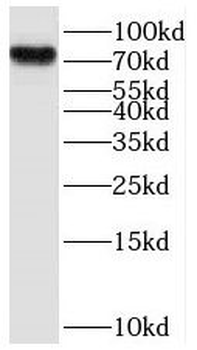 LZTS3 Rabbit Polyclonal Antibody