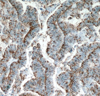 SERPINA5 Antibody