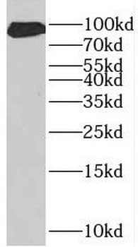 PROX1 Rabbit Polyclonal Antibody