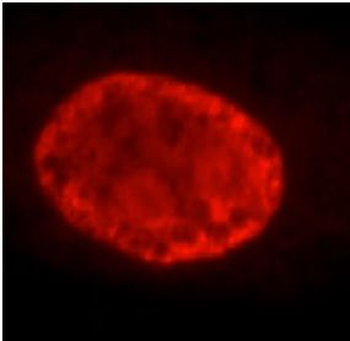 PROX1 Rabbit Polyclonal Antibody