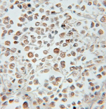 PROX1 Rabbit Polyclonal Antibody