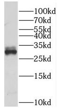 PRNP Rabbit Polyclonal Antibody