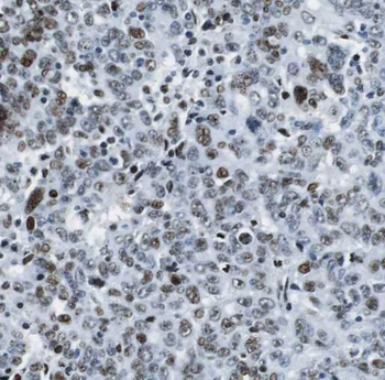 PRNP Rabbit Polyclonal Antibody