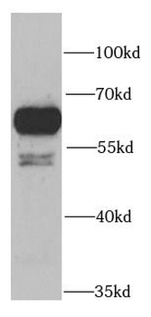 PRPF19 Rabbit Polyclonal Antibody