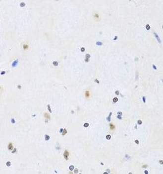PRPF19 Rabbit Polyclonal Antibody