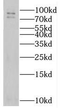 PRPF3 Rabbit Polyclonal Antibody