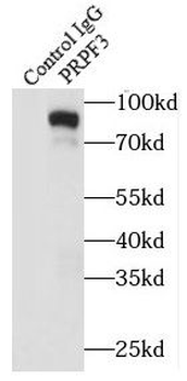 PRPF3 Rabbit Polyclonal Antibody