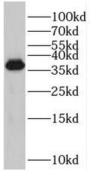 PRPF38A Rabbit Polyclonal Antibody