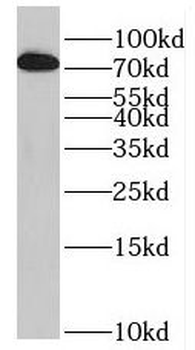 PRPF39 Rabbit Polyclonal Antibody