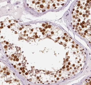 PRPF39 Rabbit Polyclonal Antibody