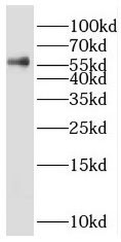 PRPF4 Rabbit Polyclonal Antibody