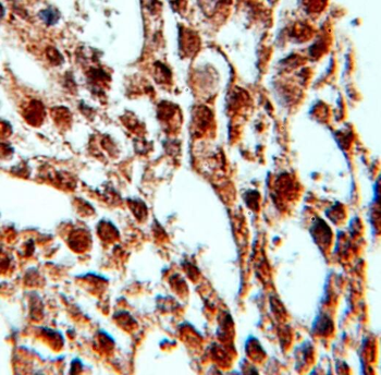 PRPF4 Rabbit Polyclonal Antibody