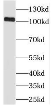 PRPF40B Rabbit Polyclonal Antibody