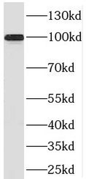 PRPF6 Antibody