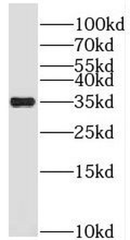 PRPS1 Rabbit Polyclonal Antibody