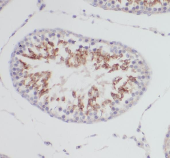 PRPS1 Rabbit Polyclonal Antibody