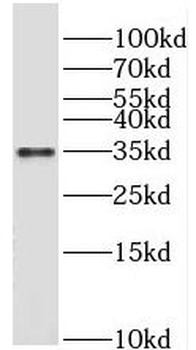 PRPS1L1 Rabbit Polyclonal Antibody