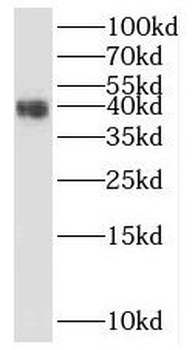 PRRT1 Rabbit Polyclonal Antibody