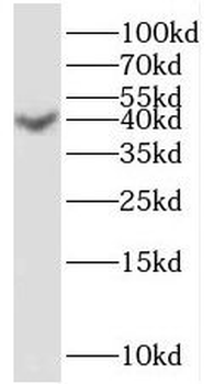 PRSS8 Rabbit Polyclonal Antibody