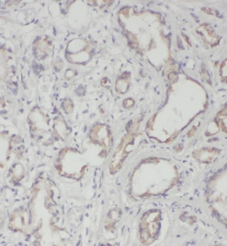 PRSS8 Rabbit Polyclonal Antibody