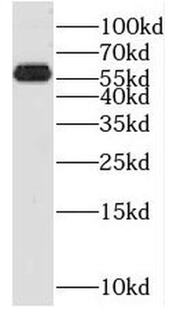 PRUNE1 Rabbit Polyclonal Antibody