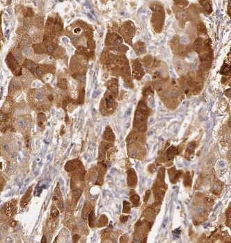 PRUNE1 Rabbit Polyclonal Antibody