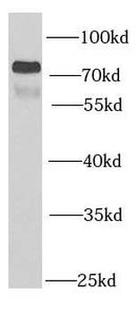 PSG1 Rabbit Polyclonal Antibody