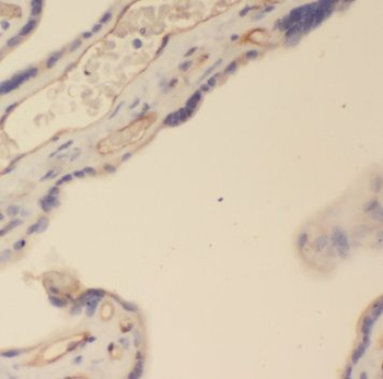 PSG4 Rabbit Polyclonal Antibody