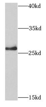 PSMB10 Rabbit Polyclonal Antibody