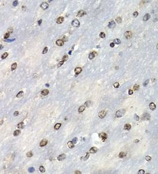 PSMB10 Rabbit Polyclonal Antibody