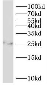 PSMB7 Rabbit Polyclonal Antibody