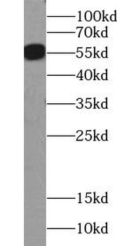 PSMC1 Rabbit Polyclonal Antibody