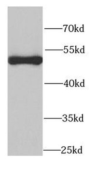 PSMC2 Rabbit Polyclonal Antibody