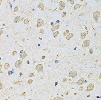 PSMC2 Rabbit Polyclonal Antibody