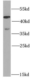 PSMC3 Rabbit Polyclonal Antibody