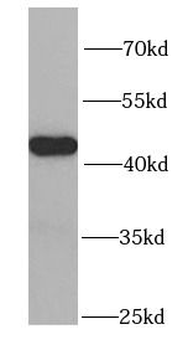 PSMC6 Rabbit Polyclonal Antibody