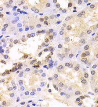 PSMC6 Rabbit Polyclonal Antibody