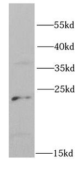 PSMD10 Rabbit Polyclonal Antibody